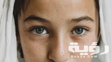 تفسير رؤية جرح الوجه في المنام