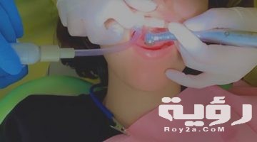 تفسير رؤية تساقط الاسنان في المنام