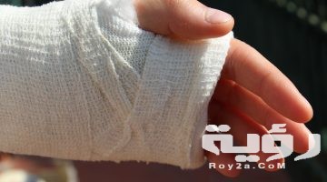 تفسير رؤية تشوه اليدين في المنام