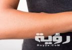 تفسير رؤية تغير لون الجلد في المنام