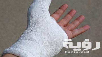 تفسير رؤية كسر اليد في المنام