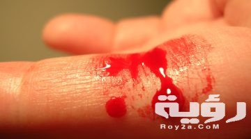 تفسير رؤية شخص ينزف دم في المنام