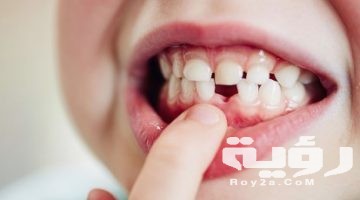 تفسير رؤية سقوط سن واحد في المنام