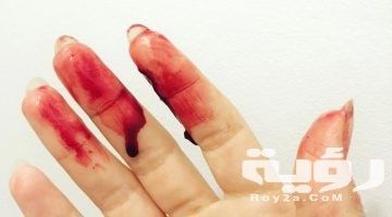 تفسير رؤية شخص قطعت يده في المنام