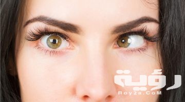 تفسير رؤية حول العين في المنام