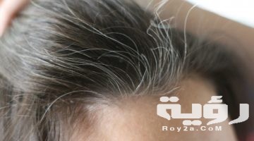 حلمت اني شعري ابيض