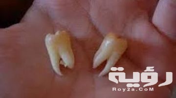حلمت اني خلعت ضرسي