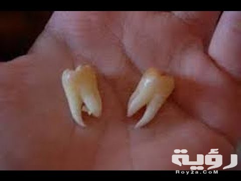 حلمت اني خلعت ضرسي