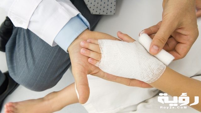 حلمت ان يدي محروقه