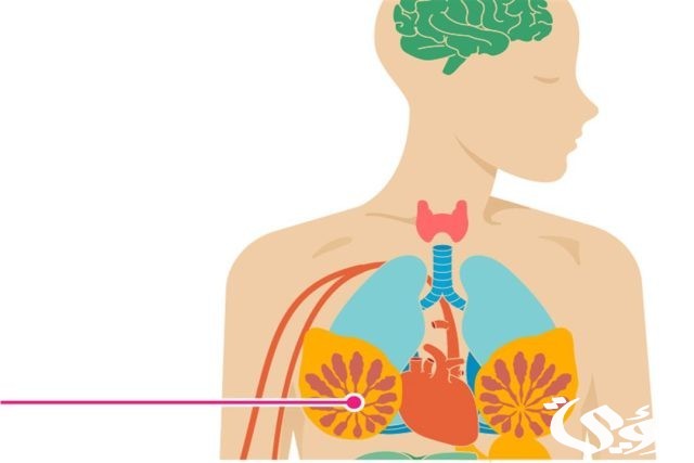 وضعية إدماجية عن سرطان الثدي