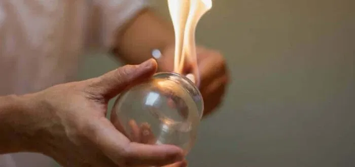 سعر الحجامة في مراكز الإمارات 2026