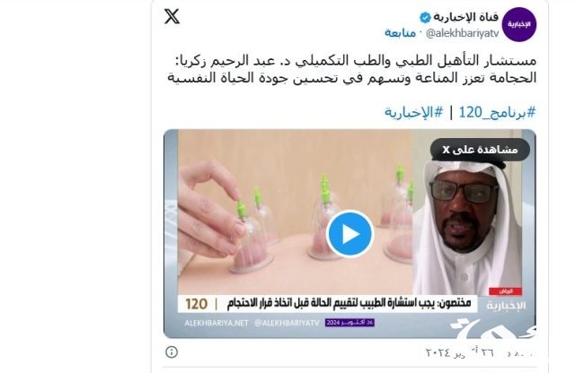 مستشار تأهيل طبي: الحجامة تحسّن الدورة الدموية للمريض وتنشط الخلايا