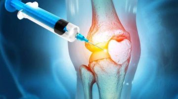 تحذيرات طبية: أضرار حُقن الكورتيزون للركبة تفوق فوائدها على المدى الطويل